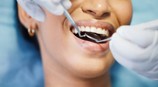 Best Emergency Broken Tooth Repair in Bacliff, TX